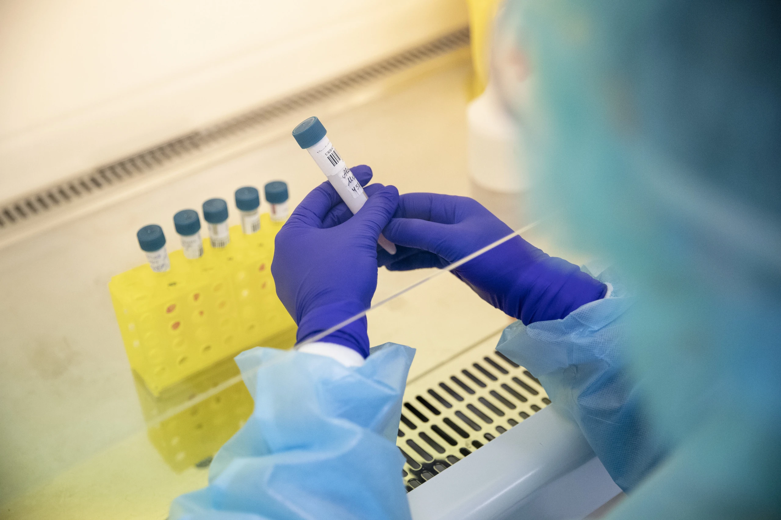 Ištyrė virš 13 tūkst. koronaviruso mėginių: vienos laboratorijos pamokos